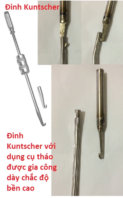 kuntscher-nail